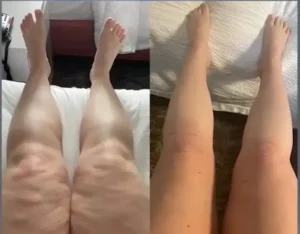 Leags-Ankles-Feet-shrink-3.webp