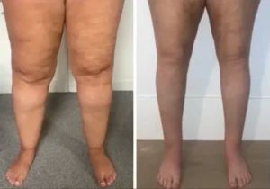 Leags-Ankles-Feet-shrink-5.webp